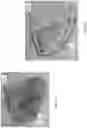 Fig. 35 - Negative pressure wound therapy apparatuses and methods for using the same
