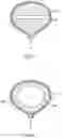 Fig. 06 - Blood pump