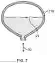 Fig. 07 - Blood pump