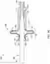 Fig. 08 - LOADING TOOLS FOR USE WITH A MEDICAL DEVICE