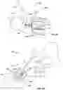 Fig. 07 - Systems and methods for anchoring medical devices
