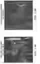Fig. 07 - System and methods for treating MVO
