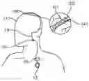 Fig. 01 - Medical device for sensing and or stimulating tissue