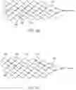 Fig. 08 - Medical device for sensing and or stimulating tissue