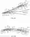 Fig. 22 - Medical device for sensing and or stimulating tissue