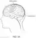 Fig. 25 - Medical device for sensing and or stimulating tissue