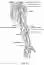 Fig. 26 - Medical device for sensing and or stimulating tissue