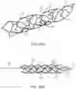 Fig. 28 - Medical device for sensing and or stimulating tissue