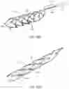 Fig. 29 - Medical device for sensing and or stimulating tissue