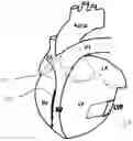 Fig. 01 - Methods and devices for ventricular therapy
