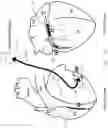 Fig. 07 - Methods and devices for ventricular therapy