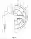 Fig. 02 - Training and rehabilitation device