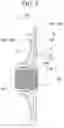 Fig. 05 - Method and device for performing additive manufacturing while rotating a spindle