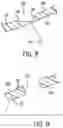 Fig. 09 - Mold, system and method for manufacturing a molded part