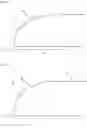 Fig. 05 - Bezel for motor vehicle glazing systems