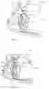 Fig. 03 - Deformable fluid supply