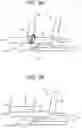 Fig. 10 - MOVEMENT ADJUSTMENT SYSTEM