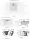 Fig. 43 - Airbags including inflator assemblies