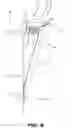 Fig. 07 - Securing mechanism for aerodynamic skirt-securing member and method of installation thereof