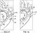 Fig. 09 - Track bar assembly and method of use for correcting thrown tracks