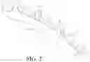 Fig. 03 - Bicycle Chainring