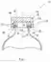 Fig. 08 - Container having an adhesively attached fitment