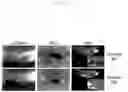Fig. 02 - Rspondins as modulators of angiogenesis and vasculogenesis