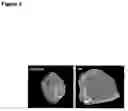 Fig. 08 - Rspondins as modulators of angiogenesis and vasculogenesis