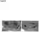 Fig. 09 - Rspondins as modulators of angiogenesis and vasculogenesis