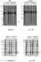 Fig. 08 - Fusion polypeptides comprising one or more inclusion body tags, methods and uses