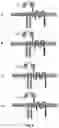 Fig. 03 - CS1 SPECIFIC MULTI-CHAIN CHIMERIC ANTIGEN RECEPTOR