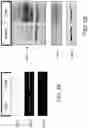 Fig. 06 - COMPOSITIONS COMPRISING SOLUBLE CD84 OR ANTI-CD84 ANTIBODIES AND METHODS FOR DIAGNOSING AND TREATING B-CLL