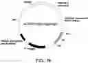 Fig. 20 - ANTIBODY SUBSTITUTING FOR FUNCTION OF BLOOD COAGULATION FACTOR VIII