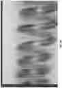 Fig. 07 - LINEAR BI-COMPONENT FILAMENT, FIBER, OR TAPE, AND METHOD OF USING THEREOF