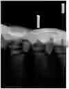 Fig. 09 - Belt or fabric including polymeric layer for papermaking machine