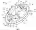 Fig. 03 - Light weight hole plug