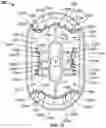 Fig. 09 - Light weight hole plug