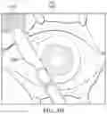Fig. 08 - SYSTEM AND METHOD OF UTILIZING SURGICAL TOOLING EQUIPMENT WITH GRAPHICAL USER INTERFACES