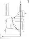 Fig. 02 - Dry sound and ambient sound separation