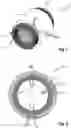 Fig. 02 - Winding of an electrical machine, electrical machine and method for producing the winding
