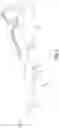 Fig. 07 - Shoe having stiffening features