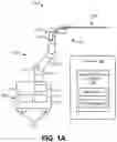 Fig. 02 - Detecting endolumenal buckling of flexible instruments