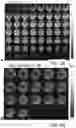 Fig. 07 - Functional Magnetic Resonance Imaging (fMRI) Methodology Using Transverse Relaxation Preparation and Non-Echo-Planar Imaging (EPI) Pulse Sequences