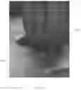 Fig. 07 - Micrometer size multi-functional probe for OCT and electro-physiological recording