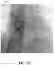 Fig. 04 - Coronary sinus-based electromagnetic mapping
