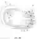 Fig. 06 - Coronary sinus-based electromagnetic mapping