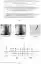 Fig. 06 - Angiography