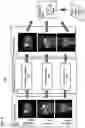 Fig. 05 - Apparatus and method for medical image reconstruction using deep learning to improve image quality in position emission tomography (PET)