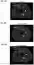 Fig. 09 - Apparatus and method for medical image reconstruction using deep learning to improve image quality in position emission tomography (PET)