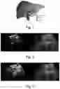 Fig. 02 - SYSTEM AND METHOD FOR CHARACTERIZING LIVER PERFUSION OF CONTRAST AGENT FLOW